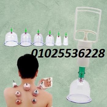 518274998_1215582583917122_5198732242614702087_n