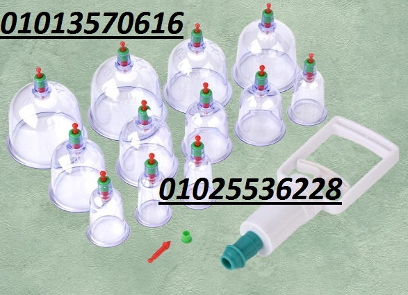 518322049_1215579497250764_3673378444832519514_n